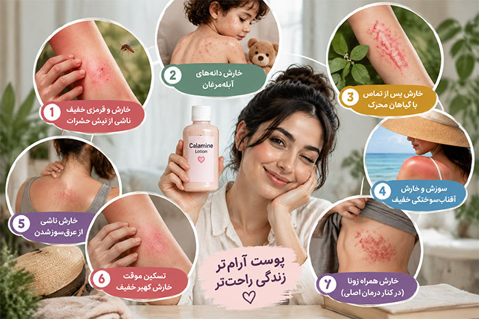 کاربردهای کالامین 